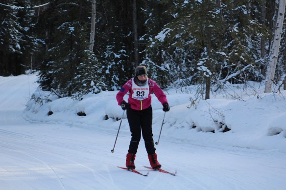 Knees needing replacement